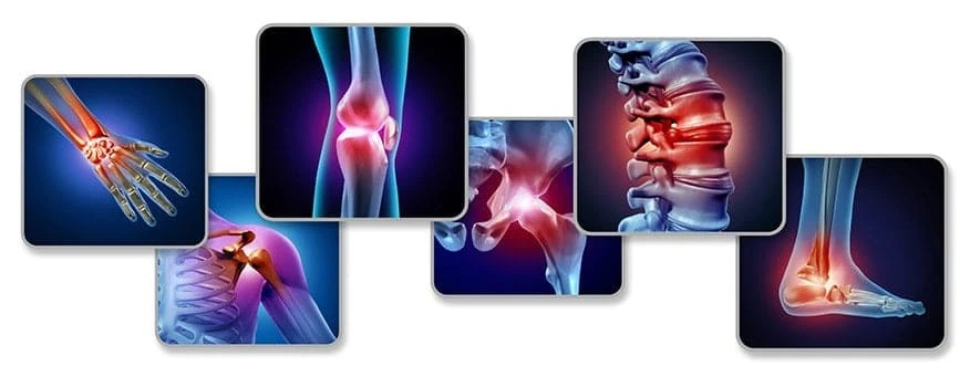 Joint Pain Encinitas, CA