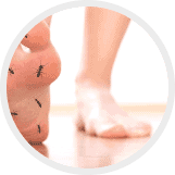 Icon illustrating a crawling-insect sensation on the feet, a symptom of peripheral neuropathy