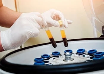 Regenerative Medicine Carlsbad, CA