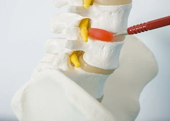 Sciatic Pain Relief Carlsbad, CA